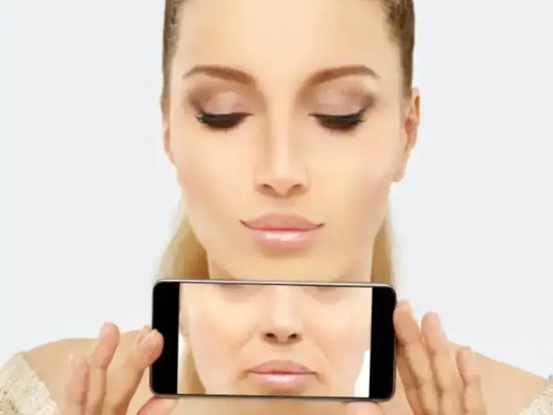 DIE BEHANDLUNG MIT RADIESSE®